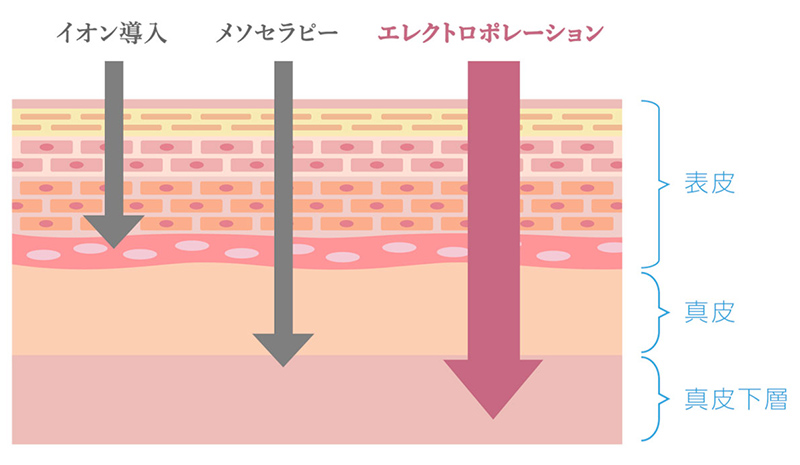 エレクトロポレーションの効果